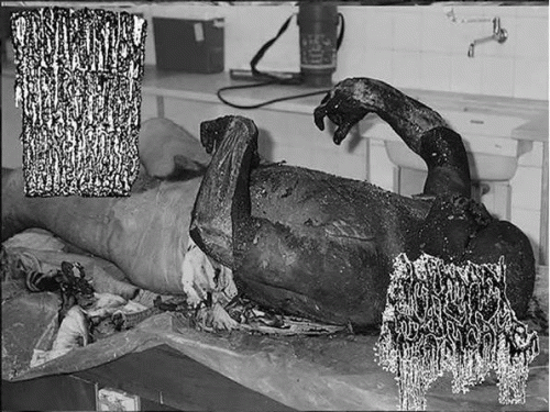 Human Pancake : Postmortem Neurofetish Bionecrosis - Human Pancake